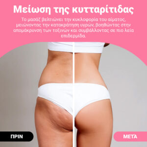 Alternative view of GUASHA – ρολό μασάζ διαμόρφωσης σώματος για ορατή μείωση κυτταρίτιδας και λίπους